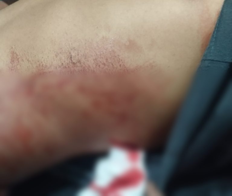 Keluarga Korban Penikaman di Maulafa Minta Polsek Maulafa Tahan Pelaku